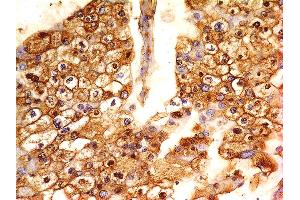 Image no. 1 for anti-V-Set Domain Containing T Cell Activation Inhibitor 1 (VTCN1) (AA 23-220) antibody (ABIN5027454)