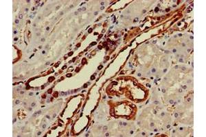 Immunohistochemistry of paraffin-embedded human kidney tissue using ABIN7155856 at dilution of 1:100 (TGIF2 anticorps  (AA 82-222))