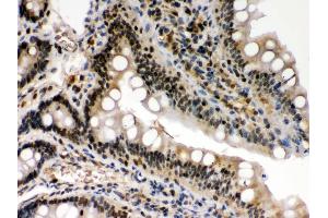IHC(P): Rat Intestine Tissue (c-Rel anticorps  (Middle Region))