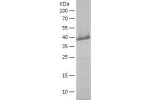 Western Blotting (WB) image for Mdm4-binding Protein (MDM4) (AA 1-300) protein (His tag) (ABIN7123868)