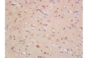 Formalin-fixed and paraffin embedded rat brain labeled with Rabbit Anti-JAMC Polyclonal Antibody, Unconjugated (ABIN1386406) at 1:200 followed by conjugation to the secondary antibody and DAB staining (JAM3 anticorps  (AA 31-130))