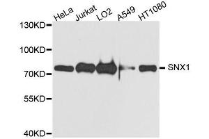 Western blot analysis of extracts of various cell lines, using SNX1 antibody. (Sorting Nexin 1 anticorps  (AA 1-150))