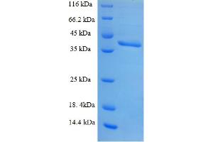 SDS-PAGE (SDS) image for Small Nuclear Ribonucleoprotein Polypeptide B (SNRPB2) (AA 1-225), (full length) protein (His-SUMO Tag) (ABIN5711087) (SNRPB2 Protein (AA 1-225, full length) (His-SUMO Tag))