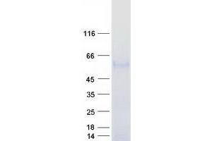 Validation with Western Blot