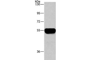 Western Blot analysis of Human plasma tissue using AHSG Polyclonal Antibody at dilution of 1:1450 (Fetuin A anticorps)