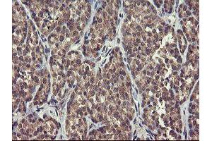 Image no. 2 for anti-rho GTPase Activating Protein 2 (ARHGAP2) antibody (ABIN1499629)