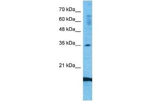 Host:  Rabbit  Target Name:  CCL18  Sample Type:  Fetal Lung lysates  Antibody Dilution:  1. (CCL18 anticorps  (Middle Region))