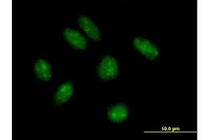 Immunofluorescence of purified MaxPab antibody to KIAA1456 on HeLa cell. (KIAA1456 anticorps  (AA 1-367))