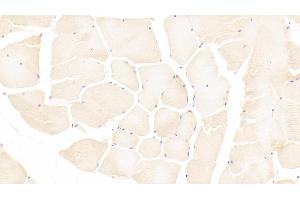 Detection of AMFR in Human Skeletal muscle Tissue using Polyclonal Antibody to Autocrine Motility Factor Receptor (AMFR) (AMFR anticorps  (AA 456-643))