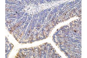 anti-Plexin A4 (PLXNA4) (C-Term) antibody