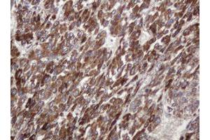 Image no. 1 for anti-TBC1 Domain Family, Member 13 (TBC1D13) antibody (ABIN1501310)