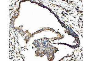 IHC analysis of CPT1A using anti-CPT1A antibody (ABIN7599853). (CPT1A anticorps  (AA 122-556))