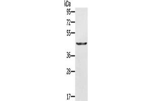 Gel: 10 % SDS-PAGE, Lysate: 30 μg, Lane: A549 cells, Primary antibody: ABIN7130044(KRT31 Antibody) at dilution 1/500, Secondary antibody: Goat anti rabbit IgG at 1/8000 dilution, Exposure time: 10 seconds (Keratin 31 anticorps)