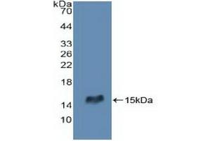 Detection of Recombinant RIPK2, Human using Polyclonal Antibody to Receptor Interacting Serine Threonine Kinase 2 (RIPK2) (RIPK2 anticorps  (AA 432-540))