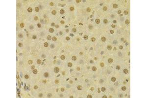 Immunohistochemistry of paraffin-embedded Human liver using COPS5 Polyclonal Antibody at dilution of 1:100 (40x lens). (COPS5 anticorps)
