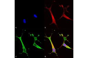 Immunocytochemistry/Immunofluorescence analysis using Mouse Anti-Copper Transporting ATPase 2 Monoclonal Antibody, Clone S62-29 (ABIN2485174).