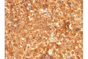 Formalin-fixed, paraffin-embedded human Fetal Liver stained with AFP Mouse Monoclonal Antibody (C2 + C3 + MBS-12). (alpha Fetoprotein anticorps)