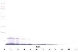 Image no. 1 for anti-Chemokine (C-C Motif) Ligand 22 (CCL22) antibody (ABIN464841) (CCL22 anticorps)