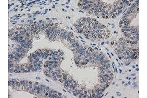 Image no. 9 for anti-ADP-Ribosylation Factor GTPase Activating Protein 1 (ARFGAP1) antibody (ABIN1496679) (ARFGAP1 anticorps)