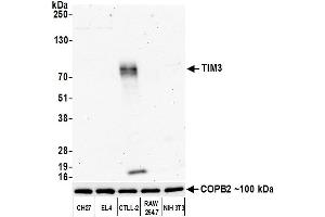 Western Blotting (WB) image for anti-Hepatitis A Virus Cellular Receptor 2 (TIM 3) (AA 231-281) antibody (ABIN7452586)