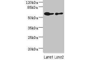 Western blot All lanes: CHRNA6 antibody at 2. (CHRNA6 anticorps  (AA 26-239))