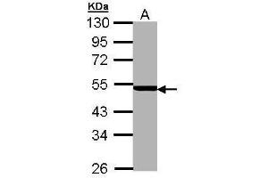 WB Image Sample (30 ug of whole cell lysate) A: MOLT4 , 10% SDS PAGE antibody diluted at 1:5000 (PSMC3 anticorps)