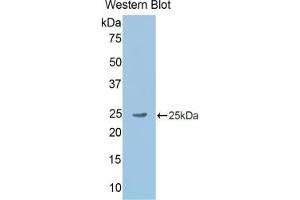 Detection of Recombinant GKN2, Rat using Polyclonal Antibody to Gastrokine 2 (GKN2)