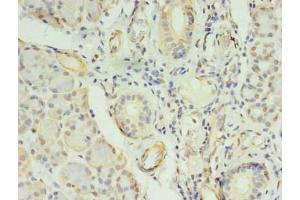 Immunohistochemistry of paraffin-embedded human pancreatic tissue using ABIN7148009 at dilution of 1:100 (COPB1 anticorps  (AA 2-200))