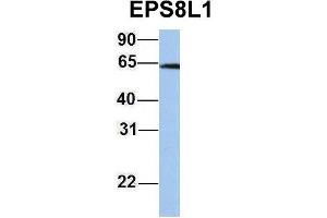 Host:  Rabbit  Target Name:  EPS8L1  Sample Type:  Jurkat  Antibody Dilution:  1. (EPS8-Like 1 anticorps  (Middle Region))