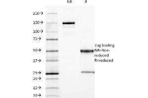 SDS-PAGE Analysis Purified CEA Mouse Monoclonal Antibody (C66/1009). (CEACAM5 anticorps)