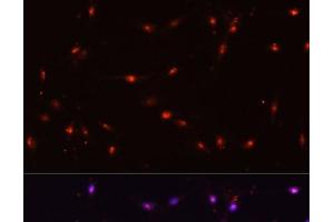 Immunofluorescence analysis of C6 cells using ILF3 Polyclonal Antibody at dilution of 1:100. (Interleukin enhancer-binding factor 3 (ILF3) anticorps)