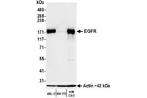 Western Blotting (WB) image for anti-Epidermal Growth Factor Receptor (EGFR) (C-Term) antibody (ABIN7795642) (Recombinant EGFR anticorps  (C-Term))