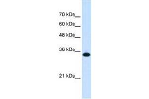 Image no. 2 for anti-Solute Carrier Family 25, Member 38 (SLC25A38) (AA 101-150) antibody (ABIN6736660) (SLC25A38 anticorps  (AA 101-150))