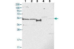 Western blot analysis of Lane 1: RT-4, Lane 2: U-251 MG, Lane 3: Human Plasma, Lane 4: Liver, Lane 5: Tonsil with SLCO4A1 polyclonal antibody . (SLCO4A1 anticorps)