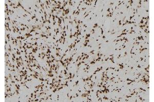 ABIN6272236 at 1/100 staining Human gastric tissue by IHC-P. (Acrosin anticorps  (N-Term))
