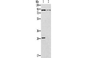 Gel: 8 % SDS-PAGE, Lysate: 40 μg, Lane 1-2: Mouse kidney tissue, Mouse brain tissue, Primary antibody: ABIN7128983(CNGA3 Antibody) at dilution 1/500, Secondary antibody: Goat anti rabbit IgG at 1/8000 dilution, Exposure time: 2 minutes (CNGA3 anticorps)