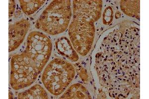 IHC image of ABIN7165952 diluted at 1:100 and staining in paraffin-embedded human kidney tissue performed on a Leica BondTM system. (PPM1J anticorps  (AA 294-505))