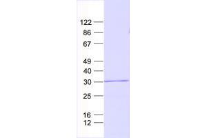 Validation with Western Blot