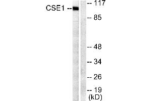 Western blot analysis of extracts from 293 cells, using CSantibody. (Exportin 2 anticorps)