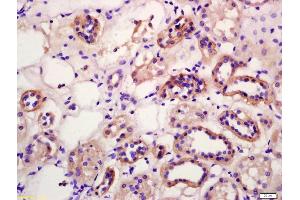 Formalin-fixed and paraffin embedded human kidney labeled with Anti-WNT12/WNT10B Polyclonal Antibody, Unconjugated (ABIN702295) at 1:200 followed by conjugation to the secondary antibody and DAB staining