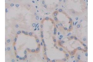 Detection of ADAM10 in Human Kidney Tissue using Polyclonal Antibody to A Disintegrin And Metalloprotease 10 (ADAM10)