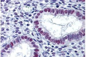 Human Uterus: Formalin-Fixed, Paraffin-Embedded (FFPE) (LSD1 anticorps  (AA 753-852))