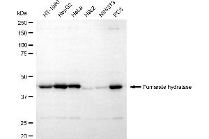 Western blotting analysis using fumarate hydratase antibody (ABIN7798663).