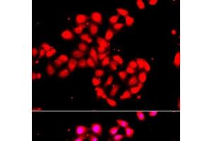 Immunofluorescence analysis of A549 cells using CAMK1D Polyclonal Antibody (CAMK1D anticorps)