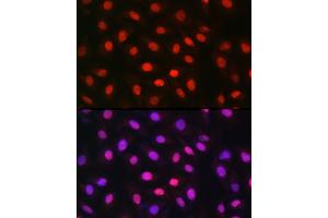 Immunofluorescence analysis of U-2 OS cells using MDC1 Rabbit pAb (ABIN6134688, ABIN6143659, ABIN6143661 and ABIN6216452) at dilution of 1:150 (40x lens). (MDC1 anticorps  (AA 1-100))