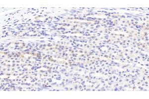 Detection of SLC in Rat Stomach Tissue using Polyclonal Antibody to Secondary Lymphoid Tissue Chemokine (SLC)