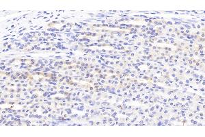 Detection of SLC in Rat Stomach Tissue using Polyclonal Antibody to Secondary Lymphoid Tissue Chemokine (SLC) (CCL21 anticorps  (AA 5-132))