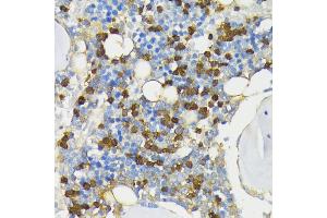Immunohistochemistry of paraffin-embedded rat bone marrow using CAMP antibody (ABIN7266146) at dilution of 1:200 (40x lens).