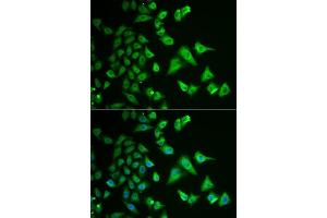 Immunofluorescence analysis of HeLa cells using DHRS2 antibody.