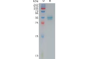 Human C(145-157) Protein, hFc Tag on SDS-PAGE under reducing condition.
